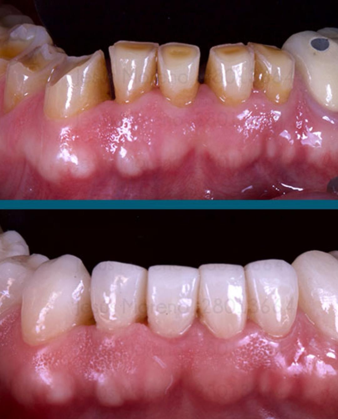 Estética dental