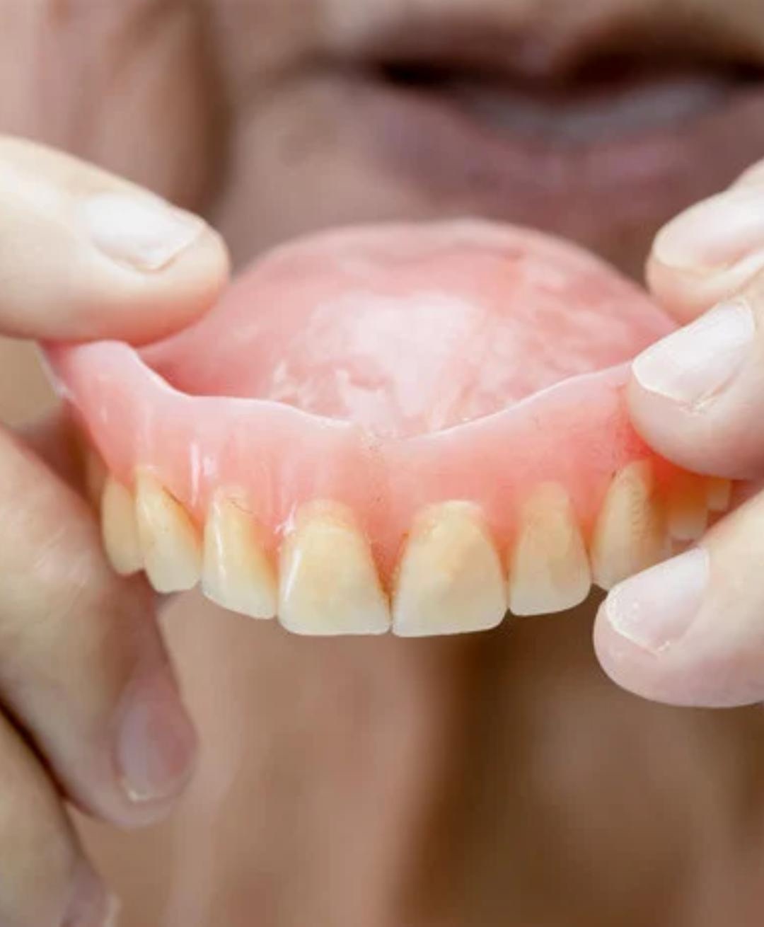 Prótesis dental